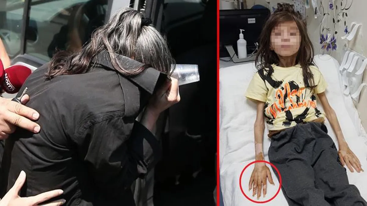 Muhammet'i çöp evde esir tutan teyze: Kendisine yaklaştırmadığı için tırnakları ve saçları uzadı