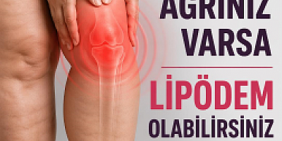 Lipödem Tedavisi Olmadan Dizdeki Sorun Çözülmez